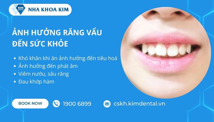 tác hại của răng vẩu