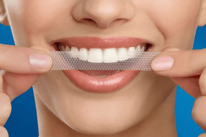 Miếng dán trắng răng được làm từ vật liệu dẻo