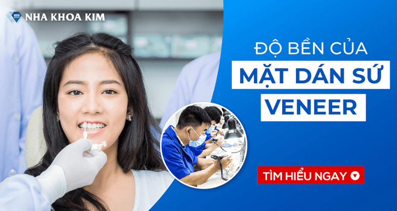 Dán răng sứ Veneer chất lượng, giá rẻ tại Nha Khoa Kim