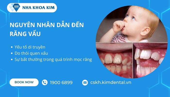 nguyên nhân gây mồm vẩu