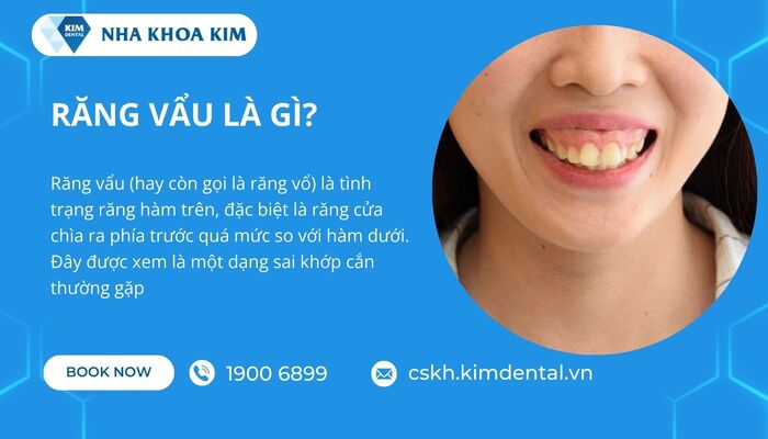 răng vẩu là gì