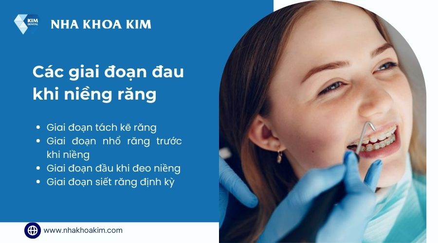 Giai đoạn đâu nhất khi niềng răng