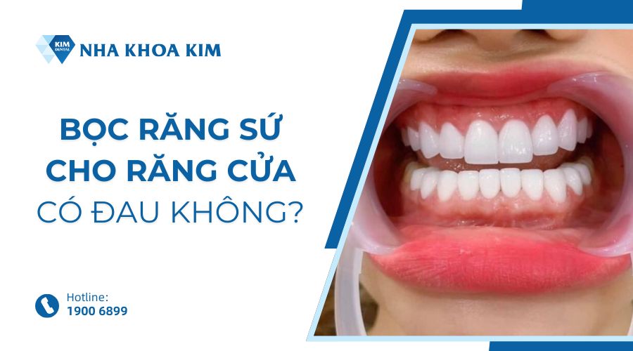 Bọc răng sứ cho răng cửa có đau không?
