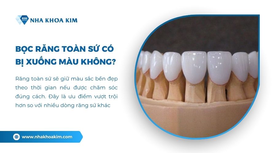 Răng toàn sứ có bị xuống màu không?