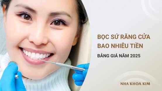 Tổng chi phí bọc sứ răng cửa bao nhiêu tiền? Bảng giá 2025