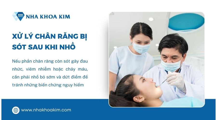 Cách xử lý chân răng bị sót khi nhổ
