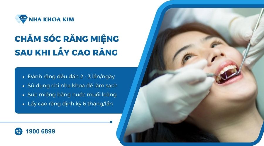 Chăm sóc răng miệng sau khi lấy cao răng