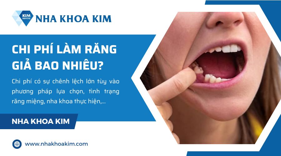 chi phí làm răng giả bao nhiêu