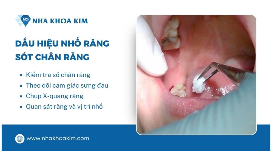 dấu hiệu nhổ răng còn sót lại chân 