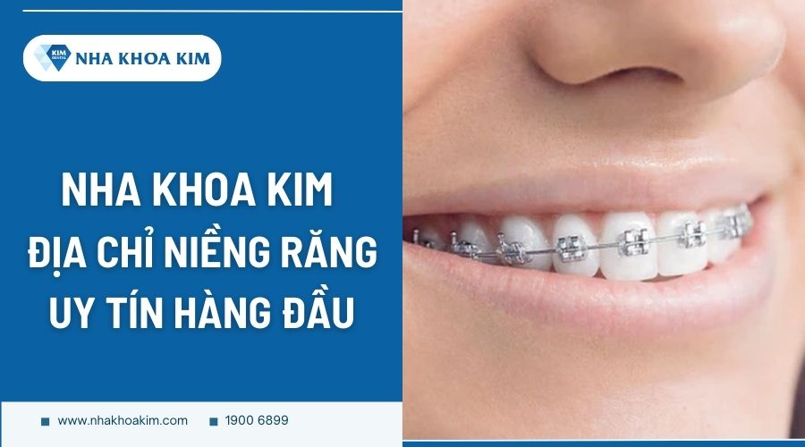 Nha Khoa Kim - Địa chỉ nha khoa niềng răng chuyên sâu an toàn