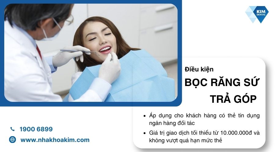 điều kiện để bọc sứ trả góp là gì
