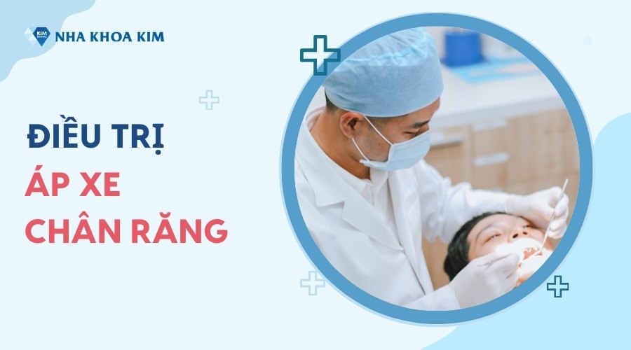 Cách điều trị áp xe chân răng hiệu quả