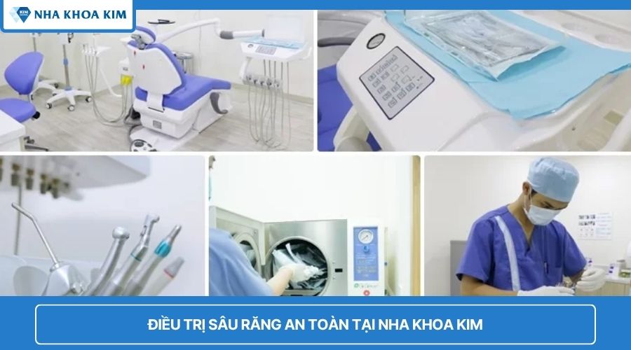 Nha Khoa Kim điều trị dứt điểm răng sâu tận tủy