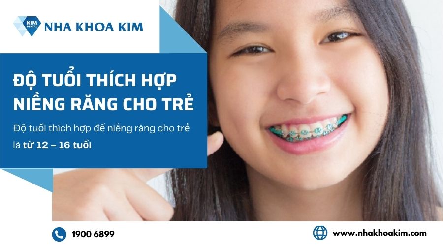 Trẻ em bao nhiêu tuổi thì niềng răng được