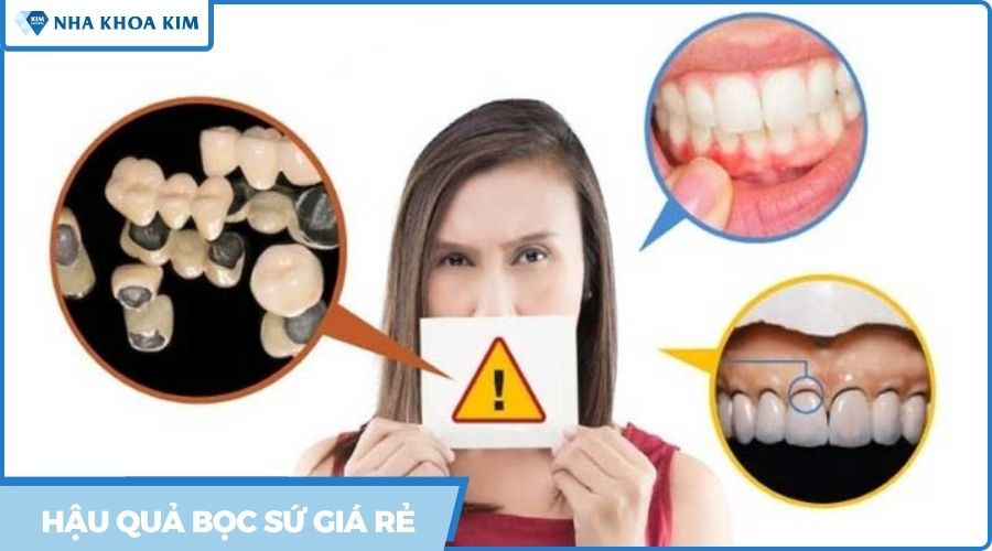 hậu quả khi bọc răng sứ giá rẻ