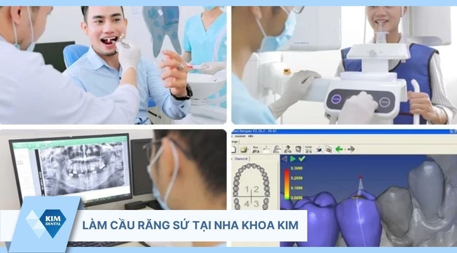 Phục hình răng tại Nha Khoa Kim