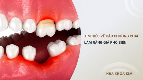 Tìm hiểu về các phương pháp làm răng giả phổ biến hiện nay