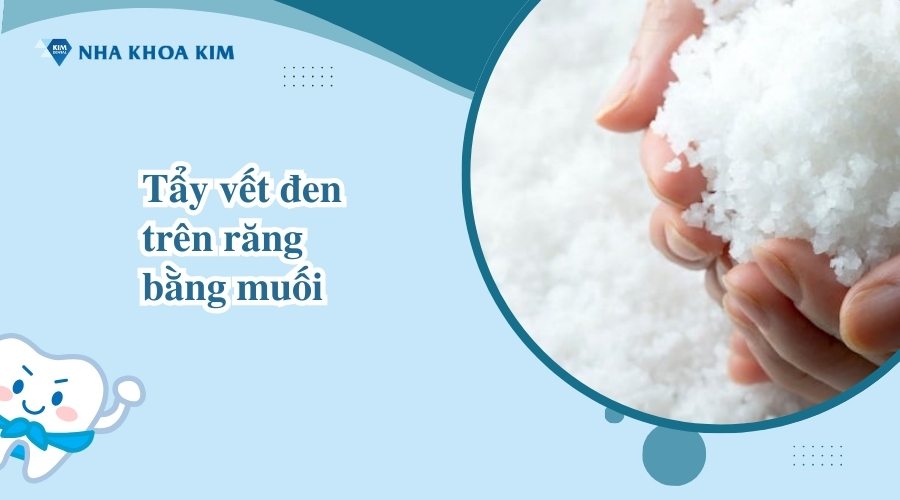 Tẩy vết đen trên răng bằng muối