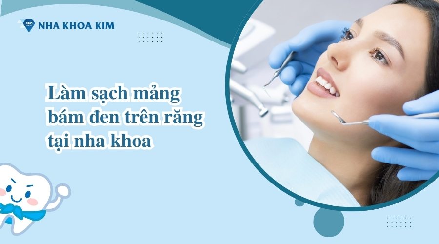 Loại bỏ mảng bám đen trên răng an toàn tại nha khoa 