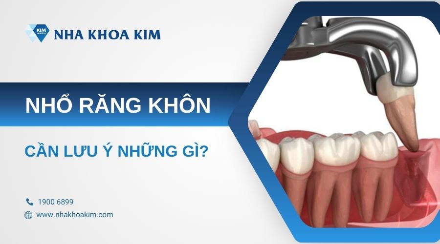 lưu ý khi nhổ răng cấm