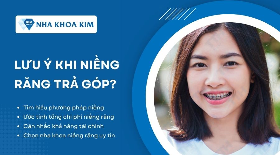 Cần lưu ý gì khi niềng răng trả góp?