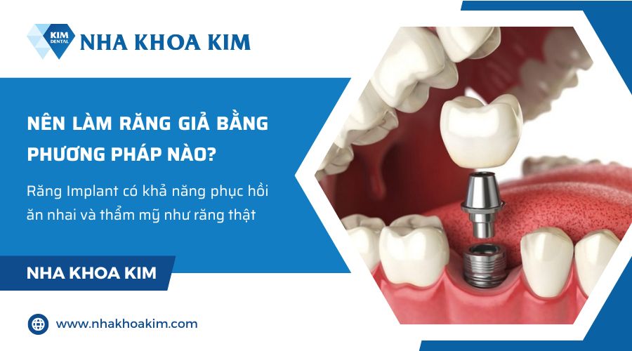 nên làm răng giả bằng phương pháp nào