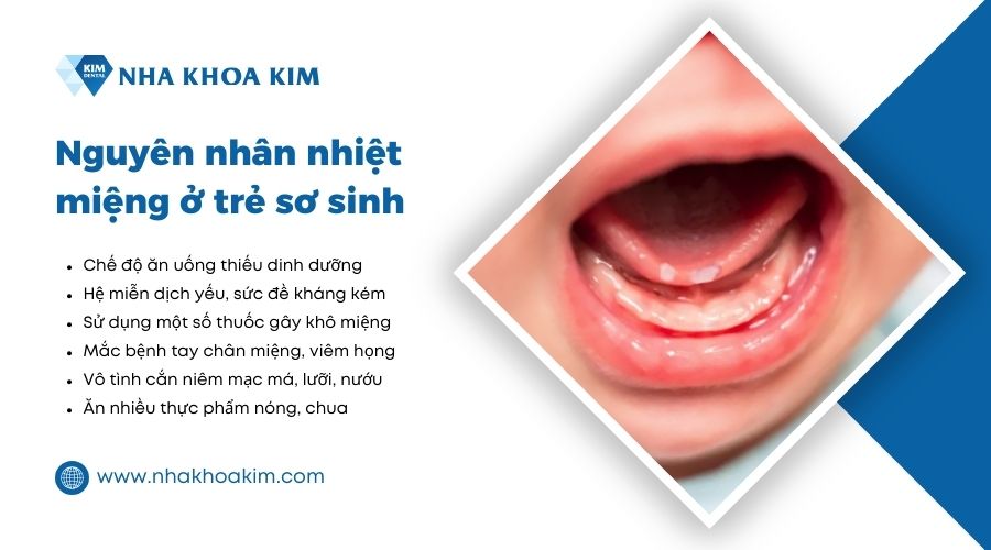 nguyên nhân nhiệt miệng ở trẻ sơ sinh