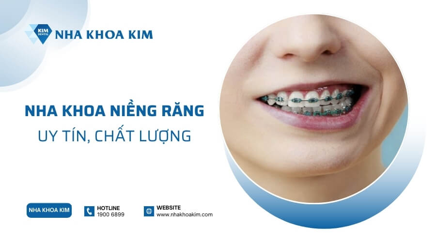 Địa chỉ niềng răng uy tín, chất lượng