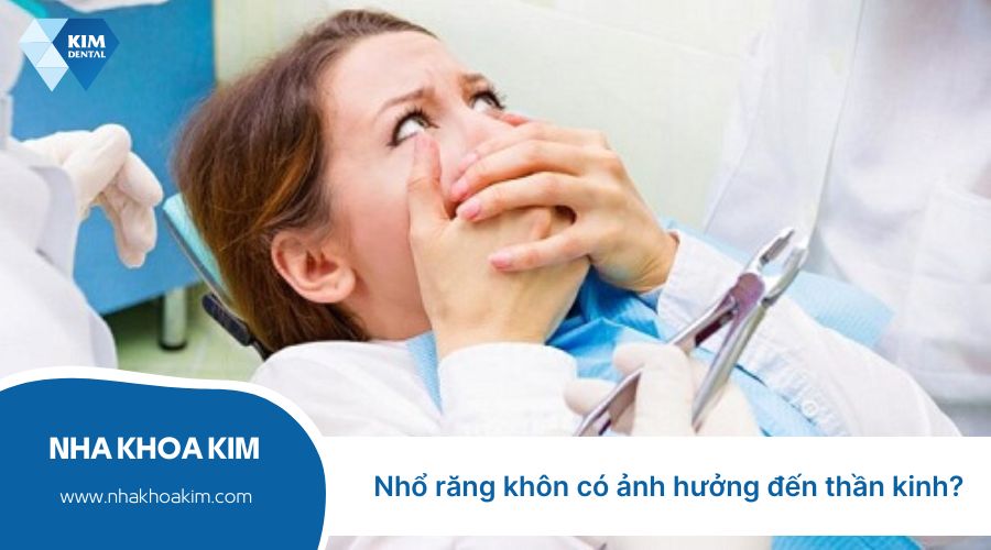 nhổ răng khôn có ảnh hưởng đến thần kinh không