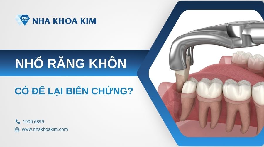Các biến chứng sau khi nhổ răng khôn