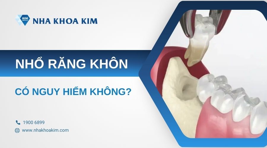 nhổ răng số 8 có nguy hiểm không