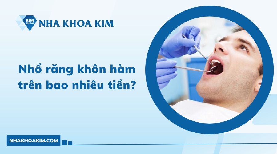 nhổ răng khôn hàm trên bao nhiêu tiền