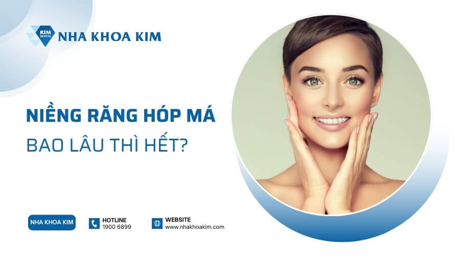 Niềng răng bao lâu thì hết hóp má?
