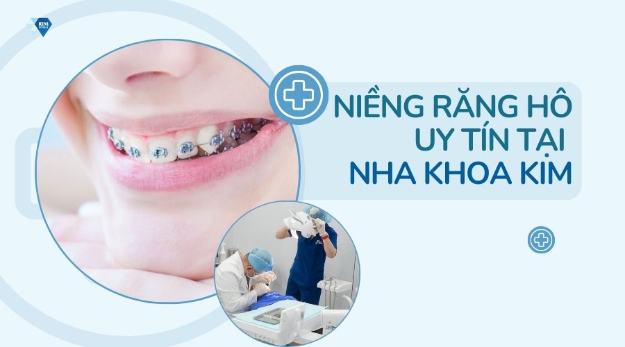 Địa chỉ niềng răng hô an toàn, uy tín