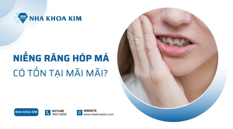 Niềng răng bị hóp má có tồn tại mãi mãi?