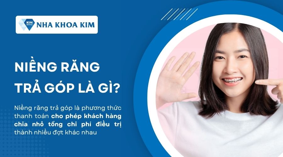 Niềng răng trả góp là gì?