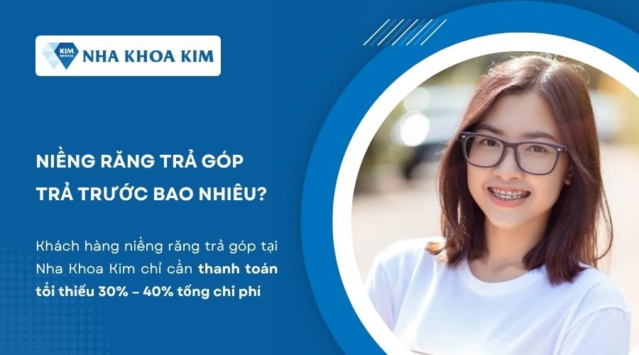 Niềng răng trả góp trả trước bao nhiêu?