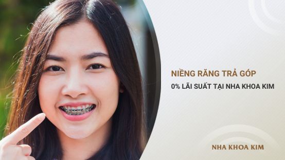 Niềng Răng Trả Góp 0% Lãi Suất Tại Nha Khoa Kim