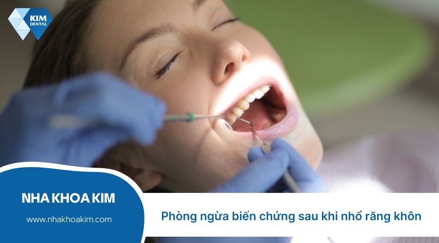 Phòng ngừa biến chứng nguy hiểm sau khi nhổ răng khôn