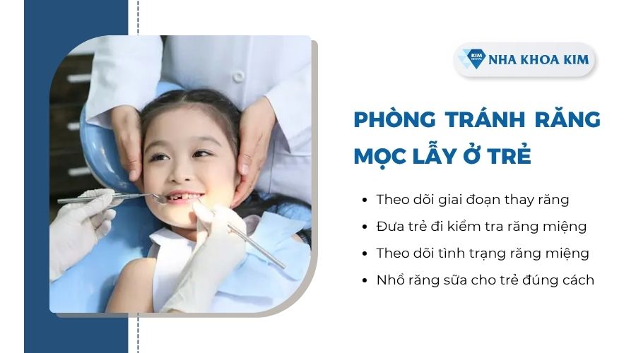 Làm sao để phòng tránh răng mọc lẫy ở trẻ