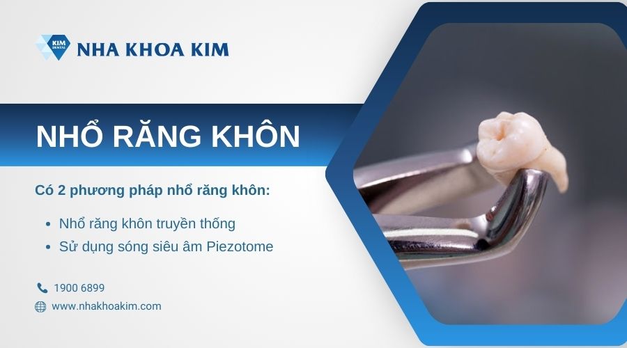 các phương pháp loại bỏ răng khôn