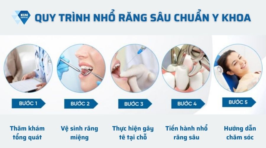 Quá trình nhổ răng sâu chuẩn y khoa
