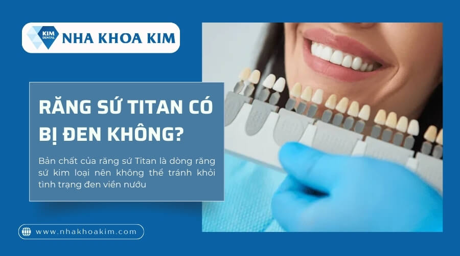 Răng sứ Titan có bị đen không?