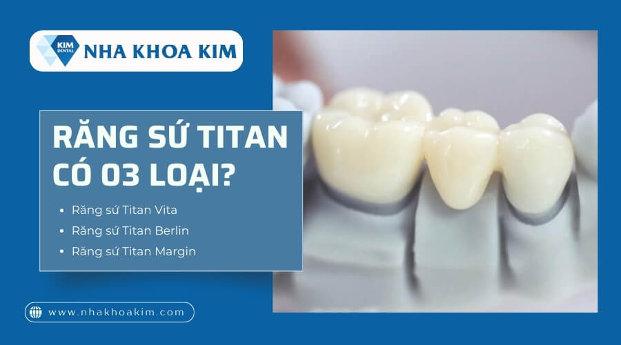 Răng sứ Titan có mấy loại