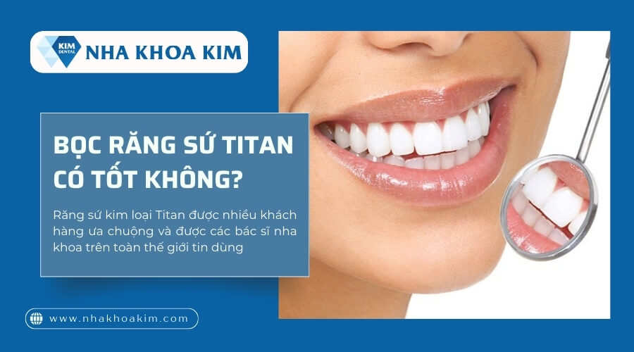 Bọc răng sứ Titan có tốt không?