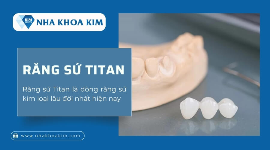 Răng sứ titan là gì?