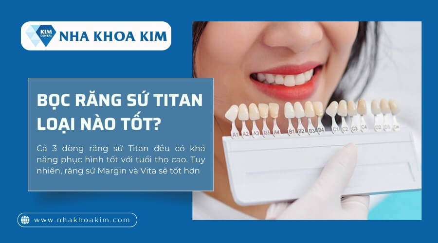Bọc răng sứ Titan loại nào tốt?