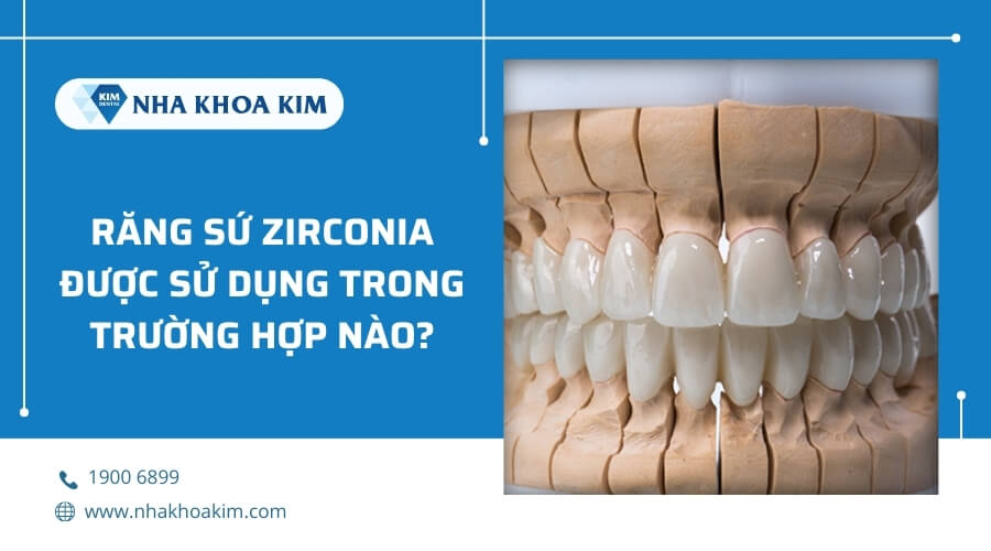 Bọc răng sứ Zirconia khi nào?