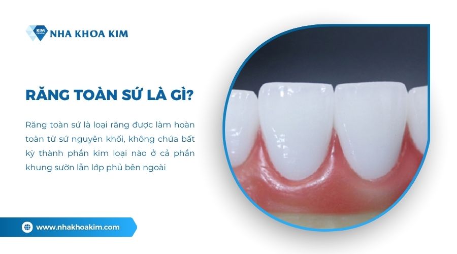 Răng toàn sứ là gì?