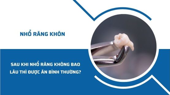 Nhổ răng khôn bao lâu thì ăn được? Cách giảm đau khi ăn